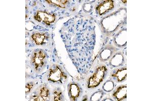 Immunohistochemistry of paraffin-embedded human kidney using [KO Validated]  Rabbit mAb  at dilution of 1:100 (40x lens). (ACE2 anticorps)