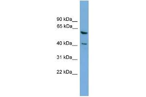 WB Suggested Anti-PINX1 Antibody Titration: 0. (PINX1 anticorps  (Middle Region))