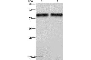 Western blot analysis of Human hepatocellular carcinoma tissue, using ELN Polyclonal Antibody at dilution of 1:400 (Elastin anticorps)
