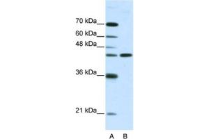 Western Blotting (WB) image for anti-Neuromedin U Receptor 2 (NMUR2) antibody (ABIN2461125) (NMUR2 anticorps)