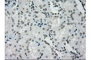 Image no. 16 for anti-Premelanosome Protein (PMEL) antibody (ABIN1500300)