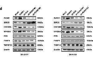 RUNX1 promoted apoptosis in NB cells and altered the transcription and protein levels of BIRC5, CSF2RB, and NFKBIA.