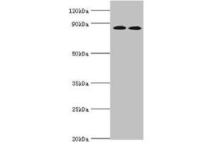 Western blot All lanes: AMP deaminase 3 antibody at 2 μg/mL Lane 1: NIH/3T3 whole cell lysate Lane 2: 293T whole cell lysate Lane 3: Mouse lung tissue Secondary Goat polyclonal to rabbit IgG at 1/10000 dilution Predicted band size: 89, 25, 77, 90, 72 kDa Observed band size: 89 kDa