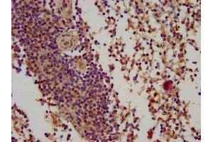 IHC image of ABIN7145780 diluted at 1:100 and staining in paraffin-embedded human spleen tissue performed on a Leica BondTM system. (BIN2 anticorps  (AA 290-496))