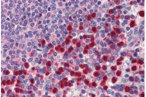 Human Spleen (formalin-fixed, paraffin-embedded) stained with TRIM35 antibody ABIN462195 followed by biotinylated goat anti-rabbit IgG secondary antibody ABIN481713, alkaline phosphatase-streptavidin and chromogen.