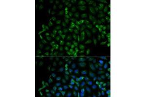 Immunofluorescence analysis of HeLa cells using Beta-TRCP Polyclonal Antibody (beta-TrCP anticorps)