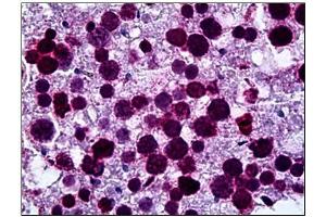 Immunohistochemistry (IHC) image for anti-Fatty Acid Desaturase 1 (FADS1) (AA 1-100) antibody (ABIN782376)
