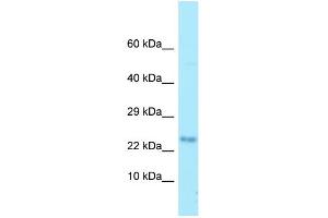 Western Blotting (WB) image for anti-Myelin Associated Oligodendrocyte Basic Protein (MOBP) (N-Term) antibody (ABIN2789776) (MOBP anticorps  (N-Term))