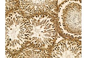 ABIN7094425 and ABIN7098472 at 1/100 staining Rat testis tissue by IHC-P.