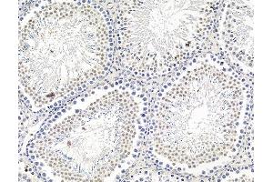 ABIN7095832 and ABIN7099894 at 1/100 staining rat testis tissue by IHC-P. (ARID5A anticorps)