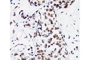 Immunohistochemistry of paraffin-embedded Human breast using Acetyl-Histone H4-K8 Polyclonal Antibody at dilution of 1:100 (40x lens).