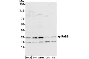 anti-RAB21, Member RAS Oncogene Family (RAB21) (AA 172-222) antibody