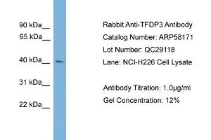 WB Suggested Anti-TFDP3  Antibody Titration: 0. (TFDP3 anticorps  (Middle Region))