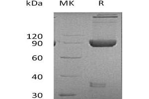 Western Blotting (WB) image for Lymphocyte-Activation Gene 3 (LAG3) protein (Fc Tag) (ABIN7320947)