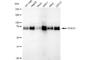 Western blotting analysis using FOXO1 antibody (ABIN7798643). (Recombinant FOXO1 anticorps)