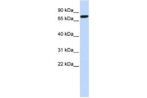 WB Suggested Anti-DLL1 Antibody Titration:  0.