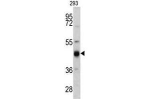 Western blot analysis of KRT13 antibody (N-term) in 293 cell line lysates (35ug/lane).