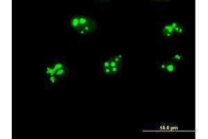 Immunofluorescence of purified MaxPab antibody to GNL3 on HeLa cell. (Nucleostemin anticorps  (AA 1-549))