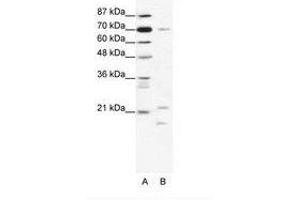Image no. 1 for anti-Basic Transcription Factor 3 (BTF3) (C-Term) antibody (ABIN203029) (BTF3 anticorps  (C-Term))