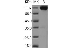 Western Blotting (WB) image for Mast/stem Cell Growth Factor Receptor (KIT) protein (Fc Tag) (ABIN7321132) (KIT Protein (Fc Tag))
