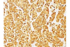 Image no. 1 for anti-Melan A (MLANA) antibody (ABIN6173309)