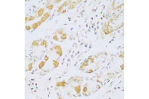 Immunohistochemistry of paraffin-embedded human stomach using FDXR antibody.