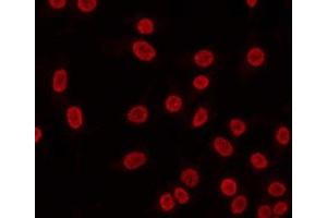ABIN6268972 staining HeLa by IF/ICC. (Cyclin H anticorps  (pThr315))
