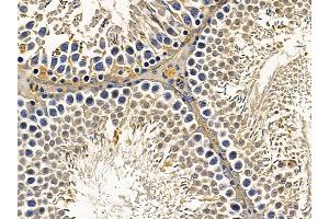 ABIN7094026 and ABIN7098070 at 1/100 staining rat testis tissue by IHC-P.