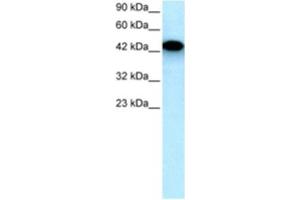 Western Blotting (WB) image for anti-Eyes Absent Homolog 3 (EYA3) antibody (ABIN2460428) (EYA3 anticorps)