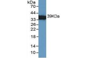 Mouse Capture antibody from the kit in WB with Positive Control: Hela cell lysate.