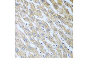 Immunohistochemistry of paraffin-embedded human liver using Eif2ak2 antibody (ABIN5973251) at dilution of 1/100 (40x lens). (EIF2AK2 anticorps)