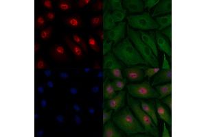 ABIN6262242 and ABIN6278080 staining  cells by IF/ICC. (HIPK2 anticorps  (N-Term))