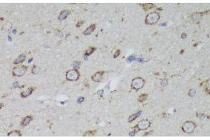 Immunohistochemistry of paraffin-embedded Rat brain using PSAP Polyclonal Antibody at dilution of 1:200 (40x lens). (Prosaposin anticorps)