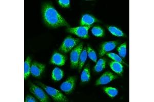 IF analysis of Kinectin 1/KTN1 using anti-Kinectin 1/KTN1 antibody (ABIN7601096). (KTN1 anticorps  (AA 283-827))