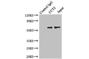 Immunoprecipitating CCT2 in Jurkat whole cell lysate Lane 1: Rabbit control IgG instead of (1 μg) instead of ABIN7171416 in Jurkat whole cell lysate. (CCT2 anticorps  (AA 206-535))