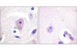 Immunohistochemistry analysis of paraffin-embedded human brain tissue, using CDC6 (Ab-54) Antibody. (CDC6 anticorps  (AA 20-69))