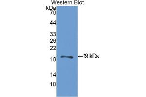 Western blot analysis of the recombinant protein. (ACP1 anticorps  (AA 1-158))