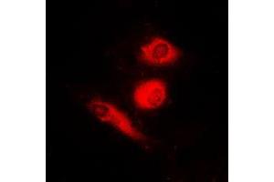 Immunofluorescent analysis of FOXO4 (pS197) staining in HeLa cells.