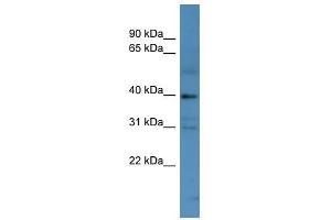 MAGEC2 antibody used at 0. (MAGEC2 anticorps  (N-Term))