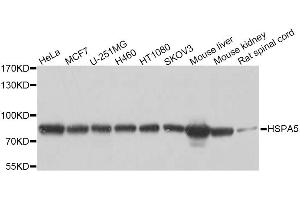 Western blot analysis of extracts of various cell lines, using HSPA5 antibody (ABIN5997936) at 1/1000 dilution. (GRP78 anticorps)