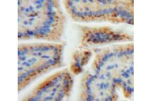 Used in DAB staining on fromalin fixed paraffin-embedded Bowels tissue (REG3A anticorps  (AA 40-164))