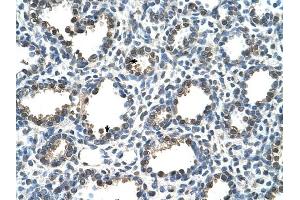RAD23A antibody was used for immunohistochemistry at a concentration of 4-8 ug/ml to stain Alveolar cells (arrows) in Human Lung. (RAD23A anticorps)
