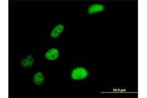 Immunofluorescence of purified MaxPab antibody to SLC4A1AP on HeLa cell. (NADAP anticorps  (AA 1-796))