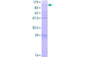 Image no. 1 for Zinc Finger Protein 16 (ZNF16) (AA 1-682) protein (GST tag) (ABIN1325904)