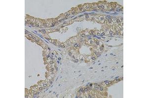 Immunohistochemistry of paraffin-embedded human prostate using ARF1 antibody. (ARF1 anticorps)