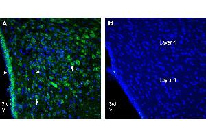 Expression of CCKBR in rat hypothalamus. (CCKBR anticorps  (Extracellular))