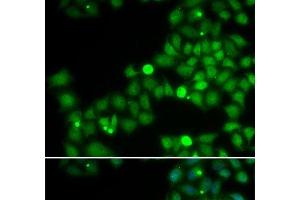 Immunofluorescence analysis of U2OS cells using POLK Polyclonal Antibody (POLK anticorps)