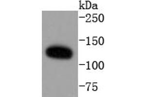 HeLa cell lysates probed with ERK5 (8D8) Monoclonal Antibody  at 1:1000 overnight at 4˚C.