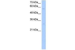 STEAP4 antibody used at 1 ug/ml to detect target protein.