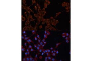 Immunofluorescence analysis of NIH/3T3 cells using Cation-independent M6PR (Cation-independent M6PR (IGF2R)) antibody (ABIN6130063, ABIN6142247, ABIN6142248 and ABIN6216853) at dilution of 1:100. (IGF2R anticorps  (AA 2327-2491))